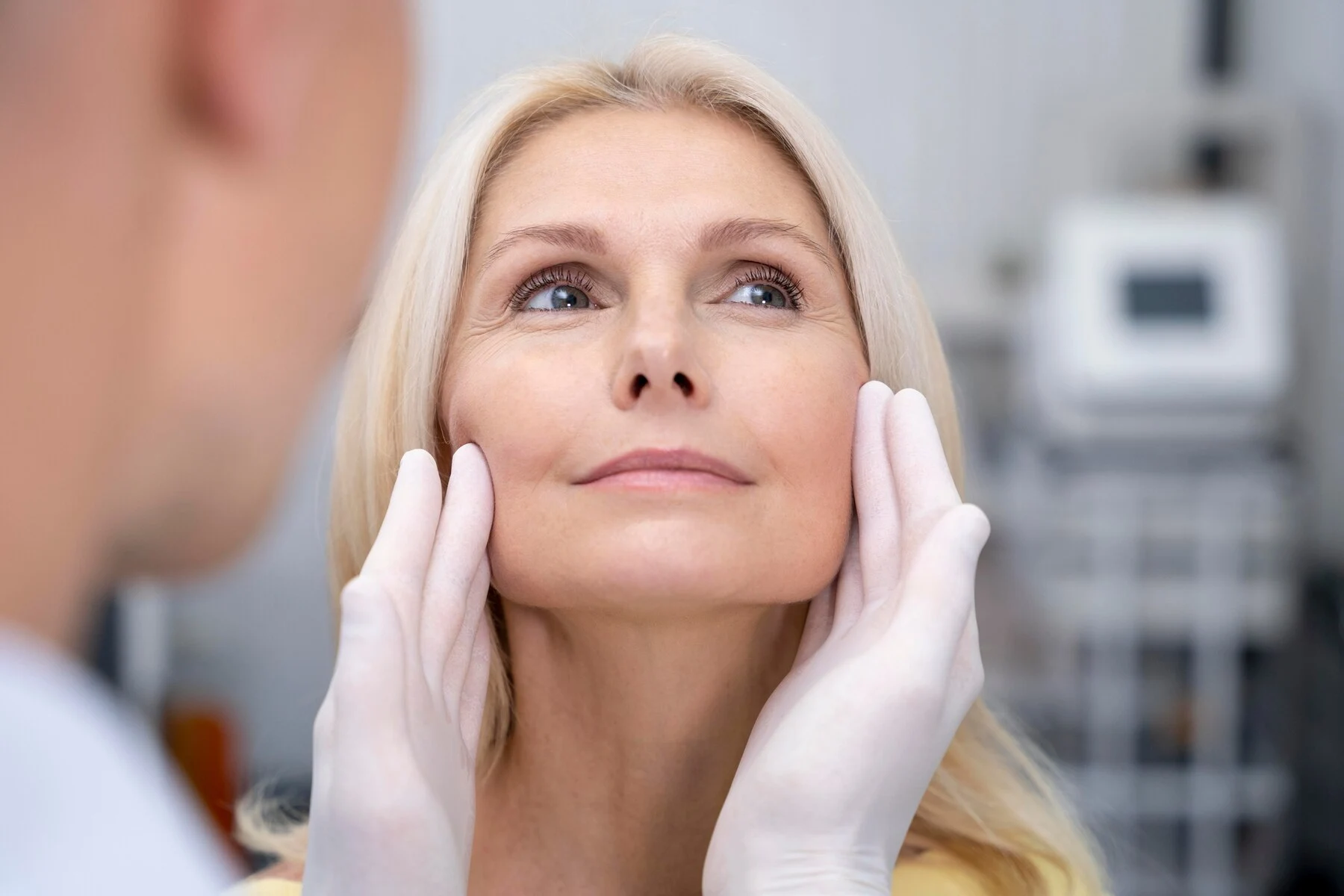Face Lift