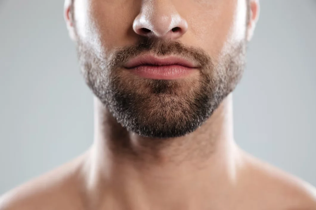 Beard Transplantation