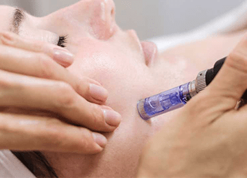 Mesotherapy