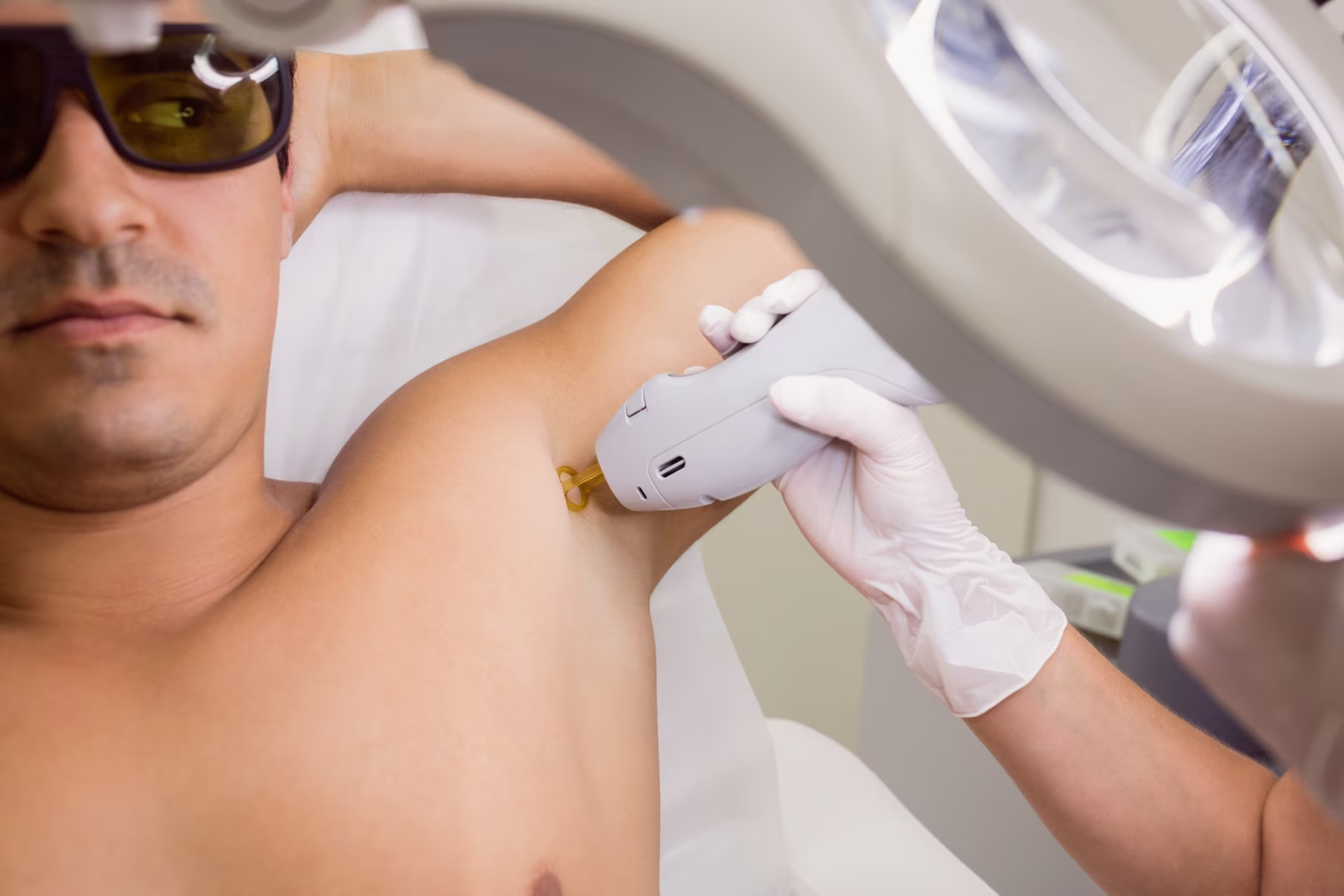 Laser Hair Removal in Men