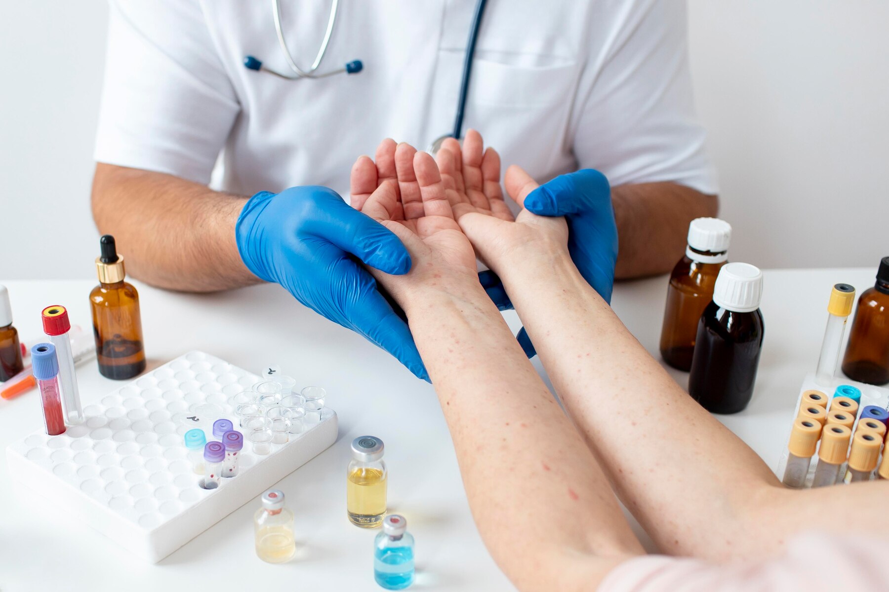 Psoriasis
