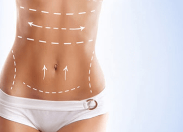 Lipomatics and Liposculpture